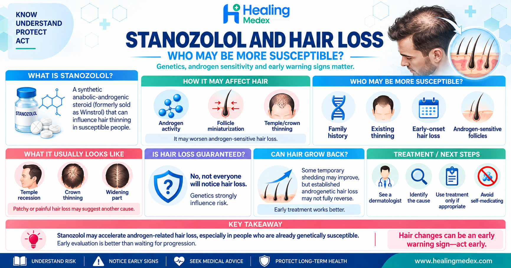 Stanozolol and Hair Loss: Who May Be More Susceptible?